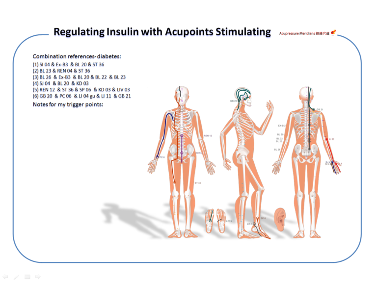 Diabetes 糖尿病 穴道配伍參考 3