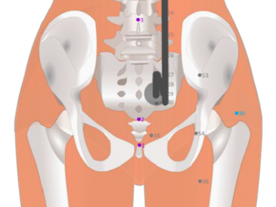 07 BL33 Zhongliao Sacral foramen 3 中髎