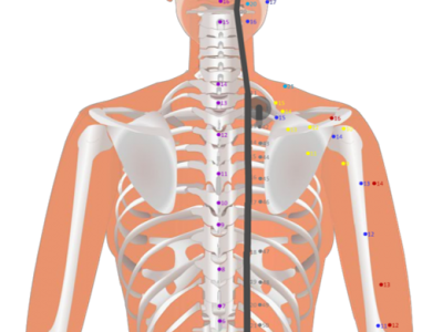 07 BL41 Fufen Attached Branch 附分