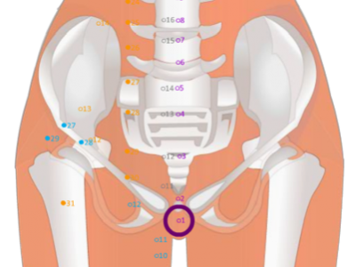 13 CV01 Huiyin Perineum 會陰