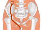 04 SP14 Fujie Abdominal Bind 腹結